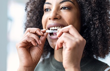 Woman inserting Invisalign over upper arch with two hands